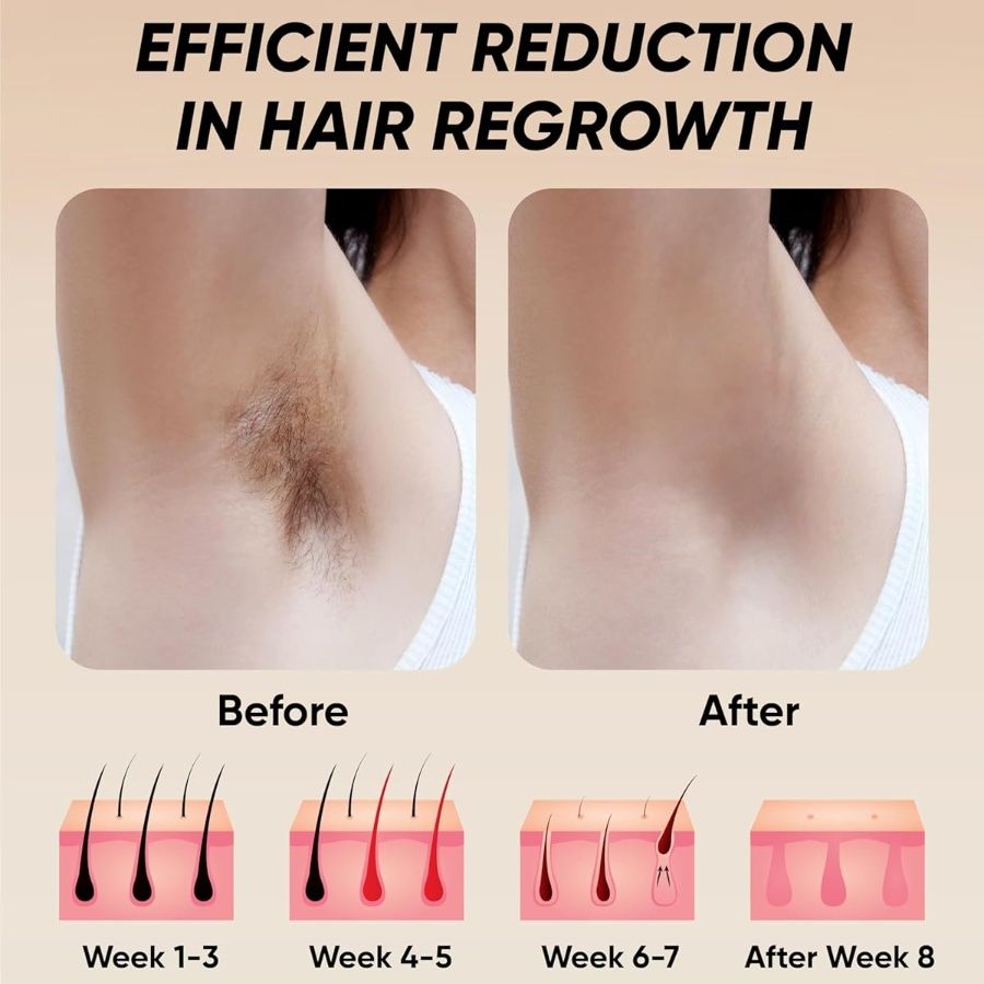 Laser Hair Removal 900,000 Flashes 5 Gears IPL Laser Epilator Hair Removal Device for Armpits Legs Arms Bikini Line LCD Display Hair Remover - Discount Msrp
