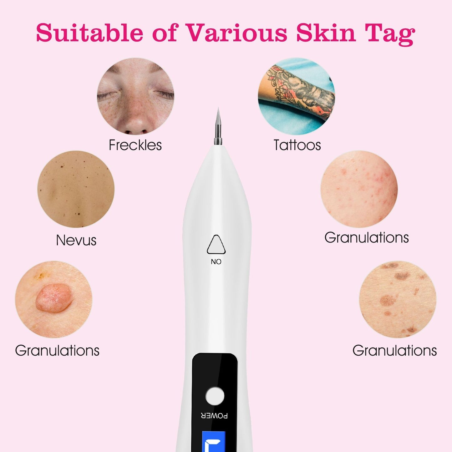 Skin Tag Repair Kit Portable Beauty Equipment Multi-Level with Home Usage USB Charging LCD Level Adjustable 6 Replaceable Needles - Discount Msrp 