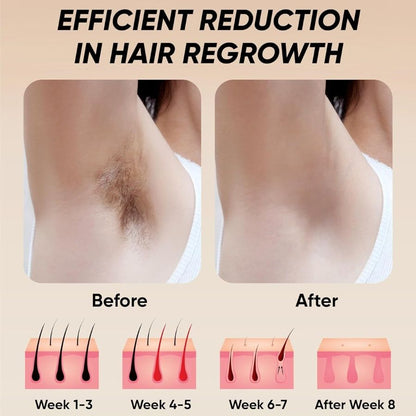 Laser Hair Removal 900,000 Flashes 5 Gears IPL Laser Epilator Hair Removal Device for Armpits Legs Arms Bikini Line LCD Display Hair Remover - Discount Msrp 