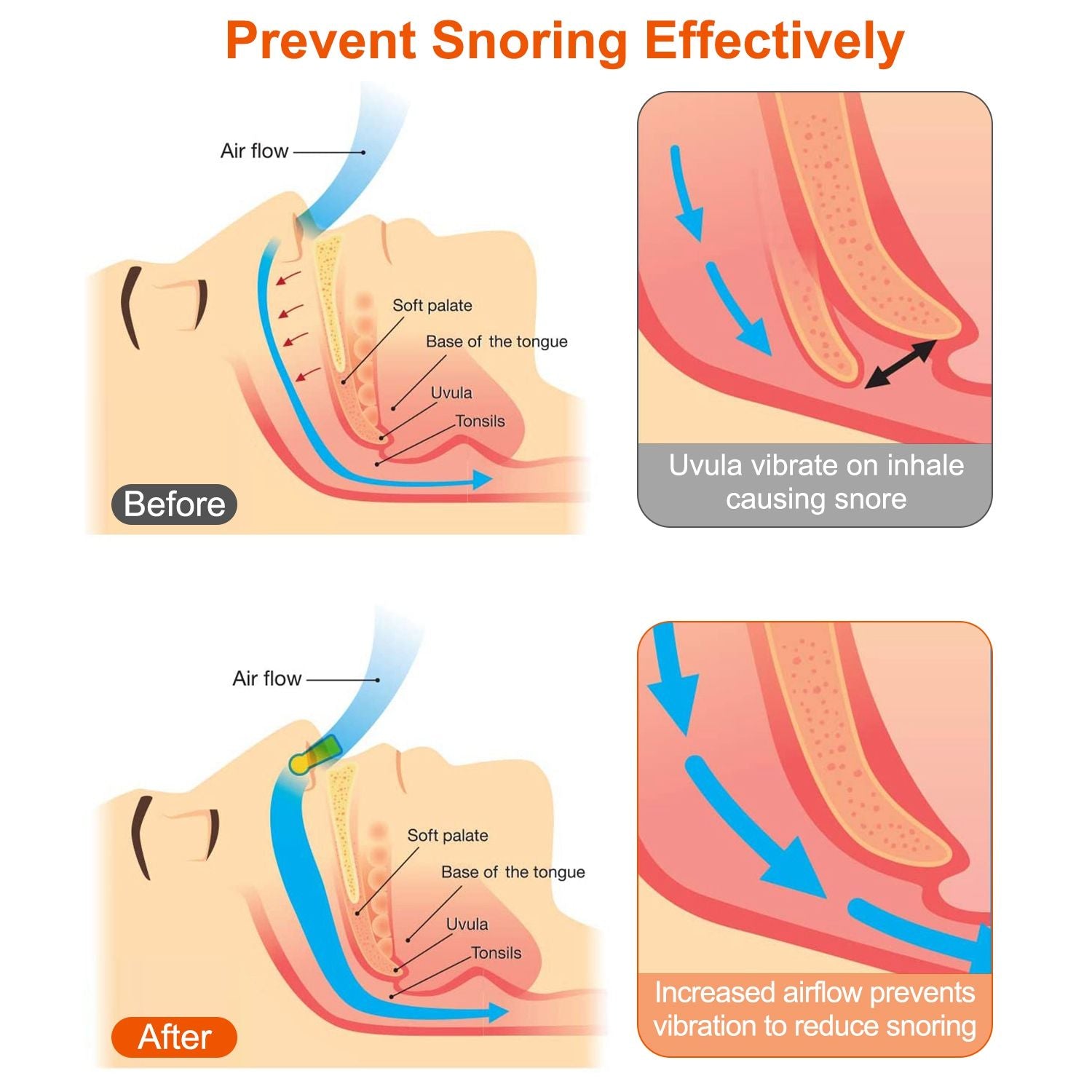 4Pcs Magnetic Nose Clip Anti Snoring Device Snore Stopper Sleeping Aid Comfortable and Reusable for Men and Women - Discount Msrp 
