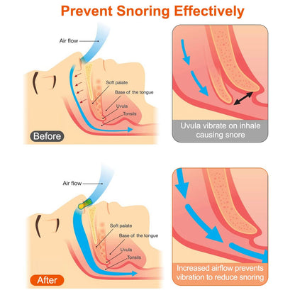 4Pcs Magnetic Nose Clip Anti Snoring Device Snore Stopper Sleeping Aid Comfortable and Reusable for Men and Women - Discount Msrp 