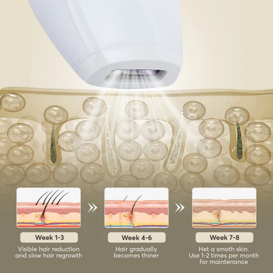 Laser Hair Removal 900,000 Flashes 5 Gears IPL Laser Epilator Hair Removal Device for Armpits Legs Arms Bikini Line LCD Display Hair Remover - Discount Msrp 